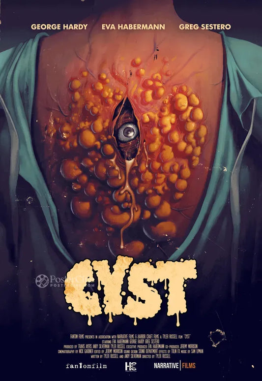 Cyst Poster